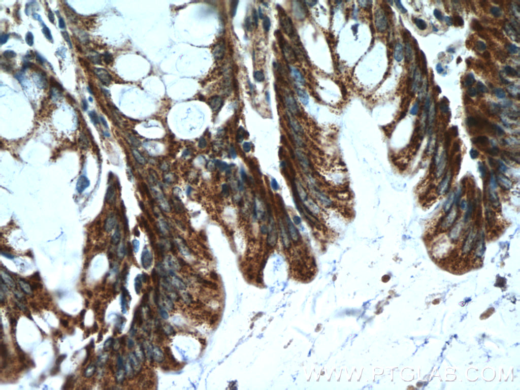 IHC staining of human colon using 25224-1-AP