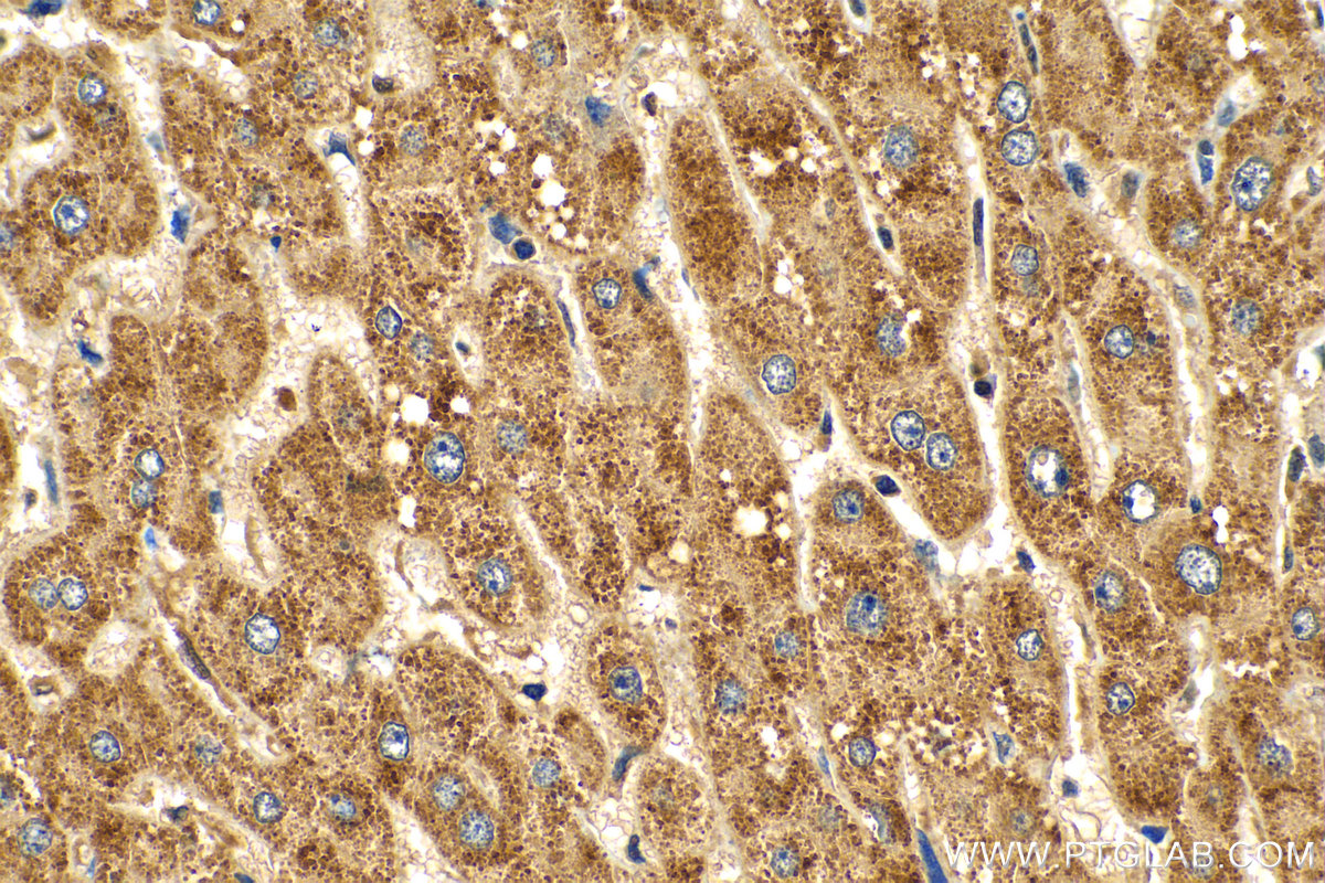 IHC staining of human liver using 25224-1-AP