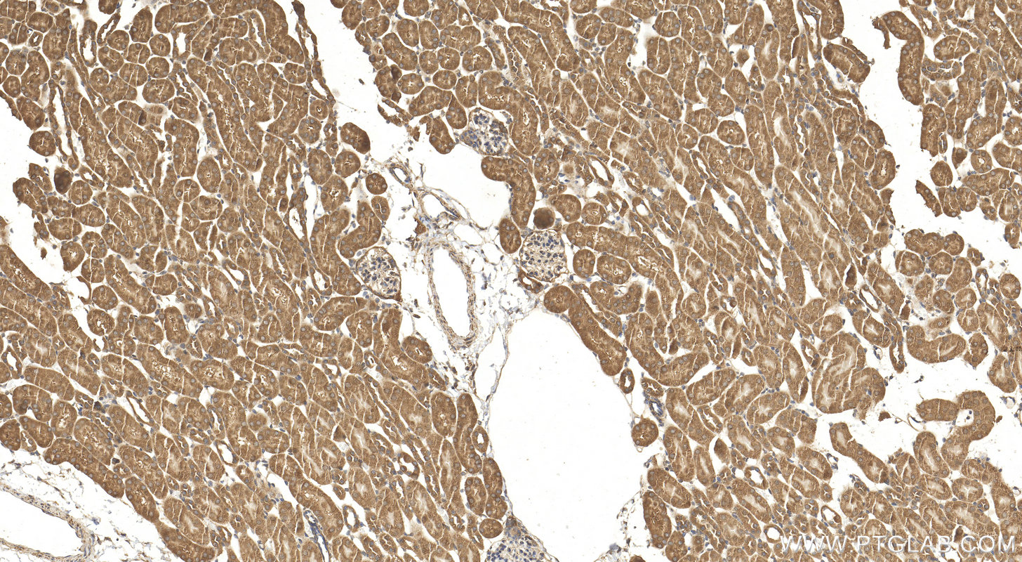 IHC staining of mouse kidney using 20162-1-AP