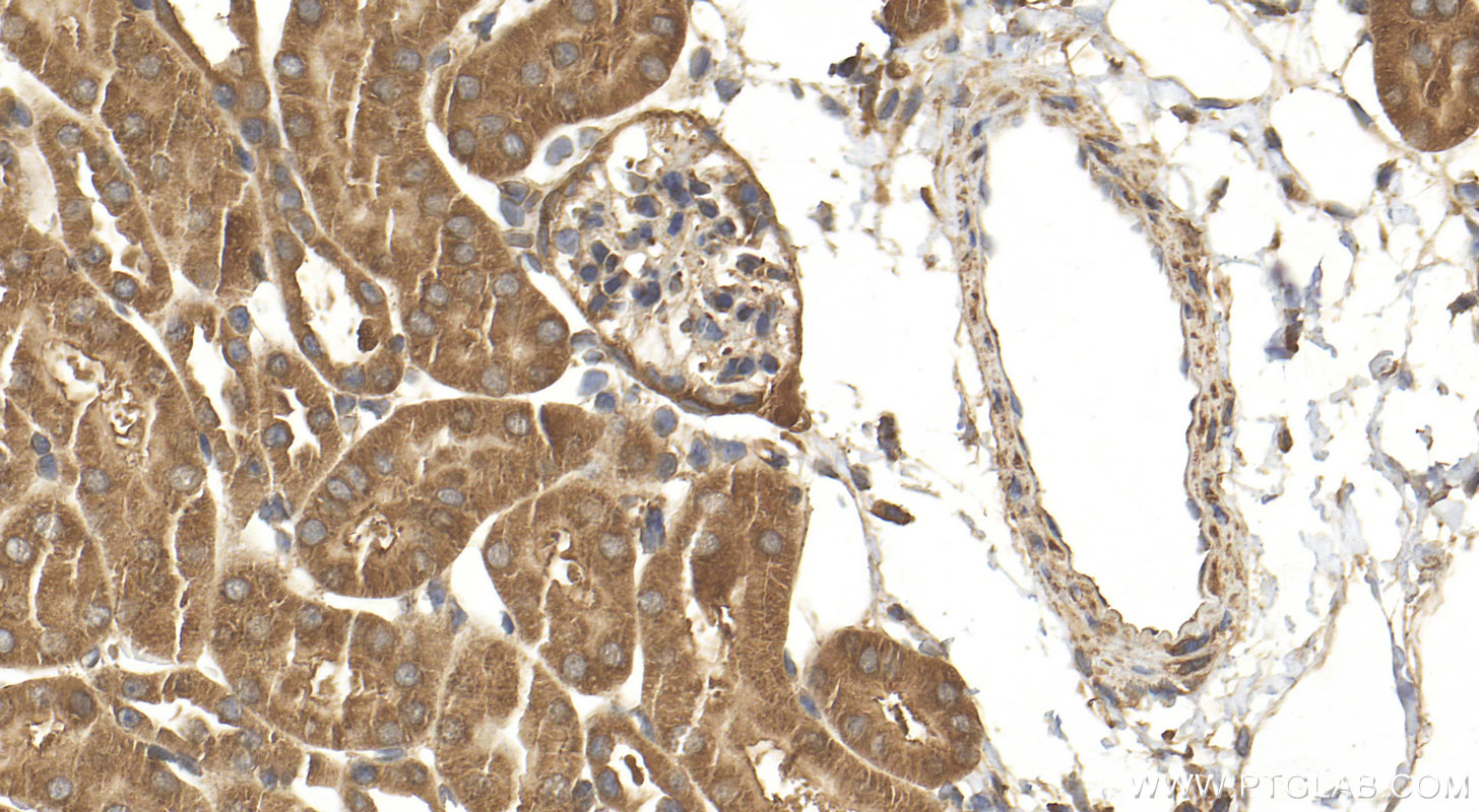 IHC staining of mouse kidney using 20162-1-AP