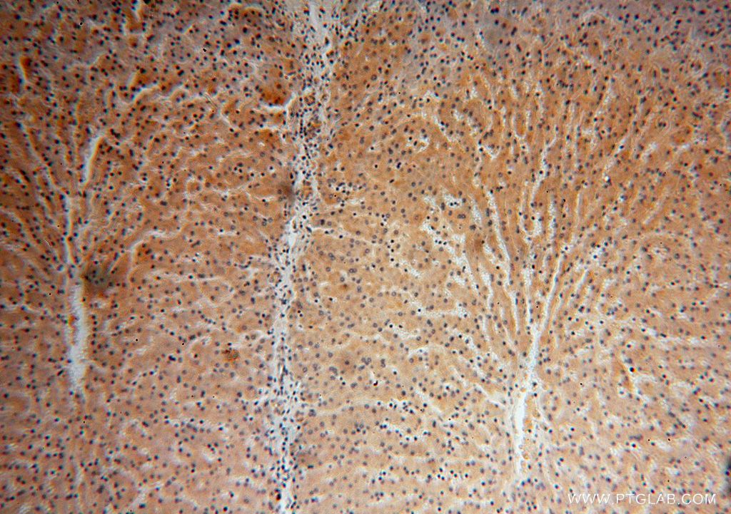 IHC staining of human liver using 16951-1-AP