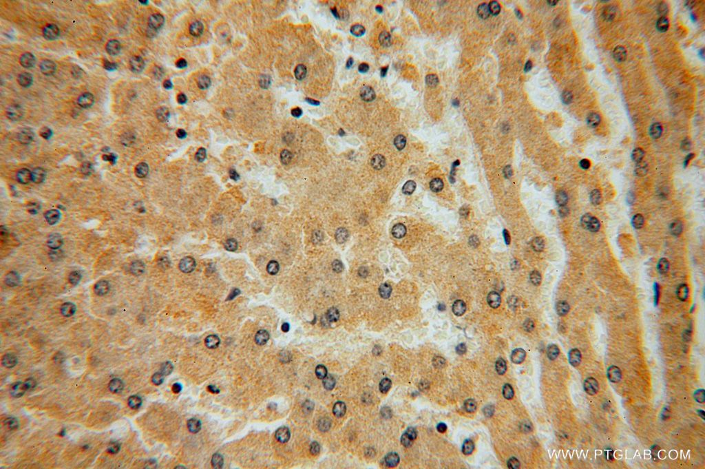 IHC staining of human liver using 16951-1-AP