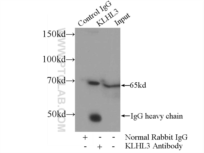 IP experiment of HepG2 using 16951-1-AP