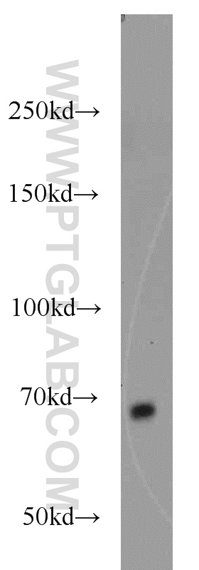 WB analysis of HepG2 using 16951-1-AP