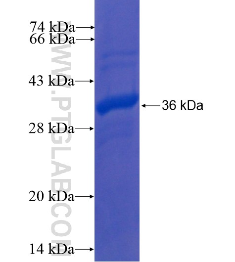 KLHL3 fusion protein Ag10843 SDS-PAGE KLHL3 fusion protein Ag10843 SDS-PAGE