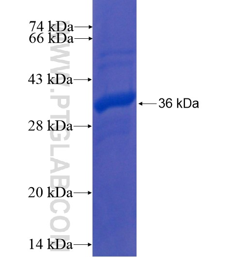 KLHL3 fusion protein Ag10843 SDS-PAGE