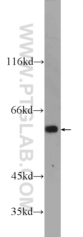 WB analysis of mouse embryo using 24781-1-AP