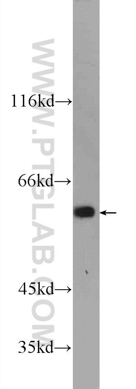 WB analysis of mouse embryo using 24781-1-AP