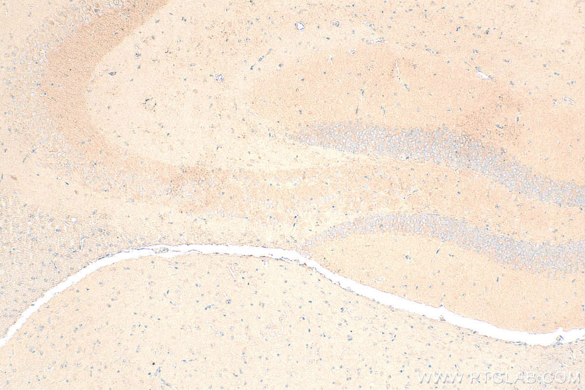 IHC staining of mouse brain using 28621-1-AP (same clone as 28621-1-PBS) IHC staining of mouse brain using 28621-1-AP (same clone as 28621-1-PBS)