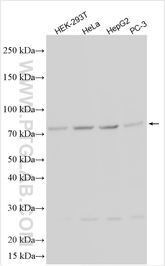 WB analysis using 28621-1-AP