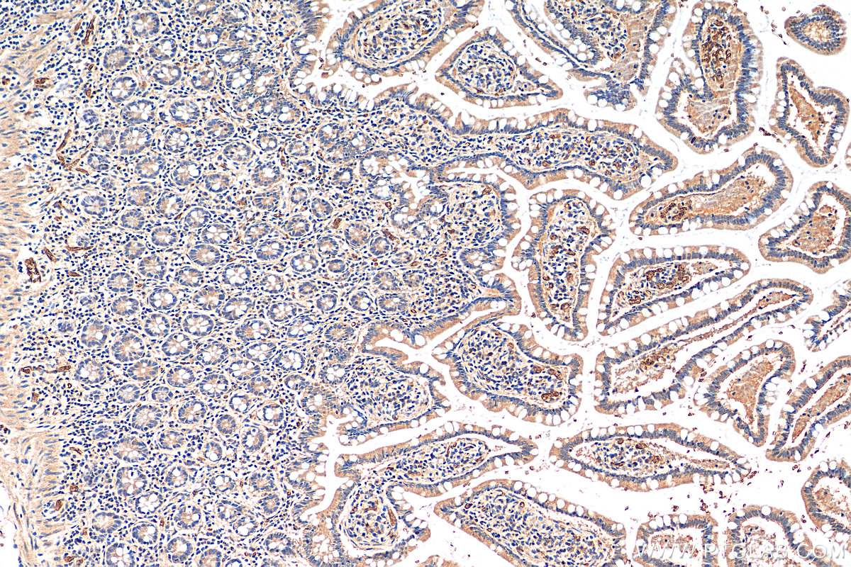 IHC staining of human small intestine using 21981-1-AP