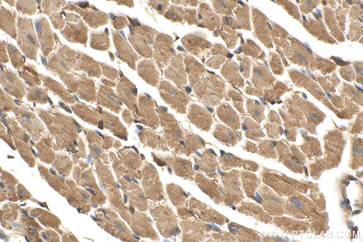 IHC staining of mouse heart using 21199-1-AP