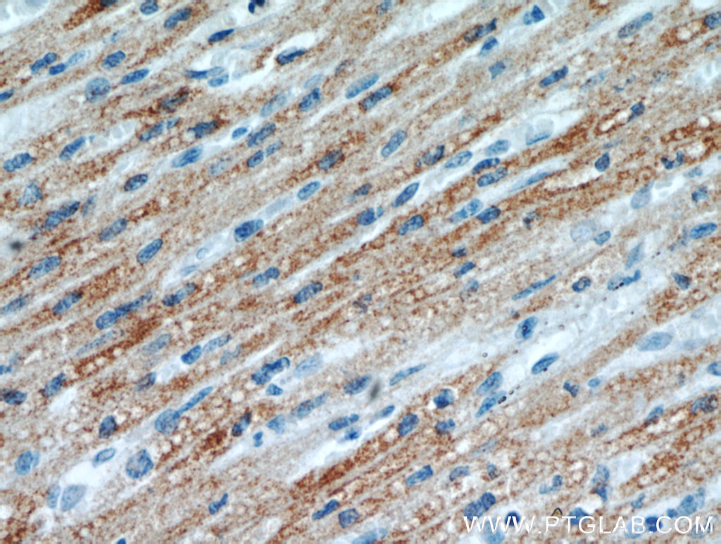 IHC staining of human heart using 21199-1-AP