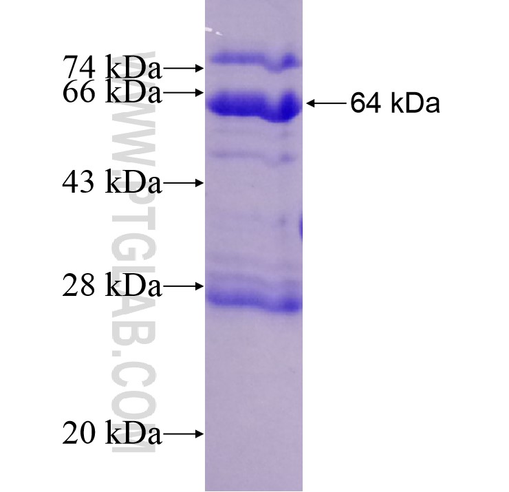 KLHL36 fusion protein Ag14007 SDS-PAGE KLHL36 fusion protein Ag14007 SDS-PAGE