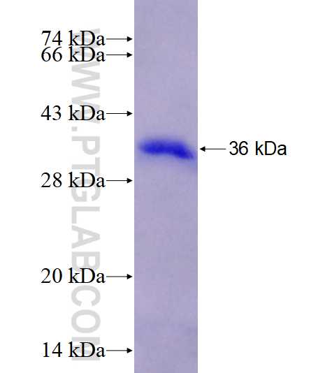 KLHL38 fusion protein Ag28165 SDS-PAGE KLHL38 fusion protein Ag28165 SDS-PAGE