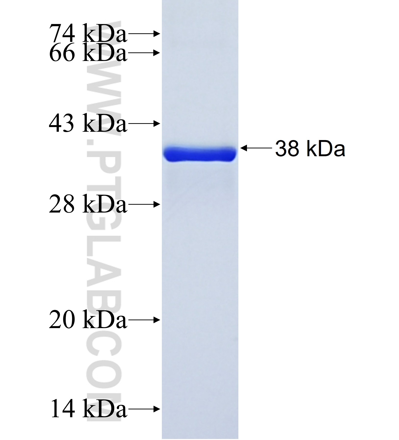 KLHL4 fusion protein Ag41970 SDS-PAGE