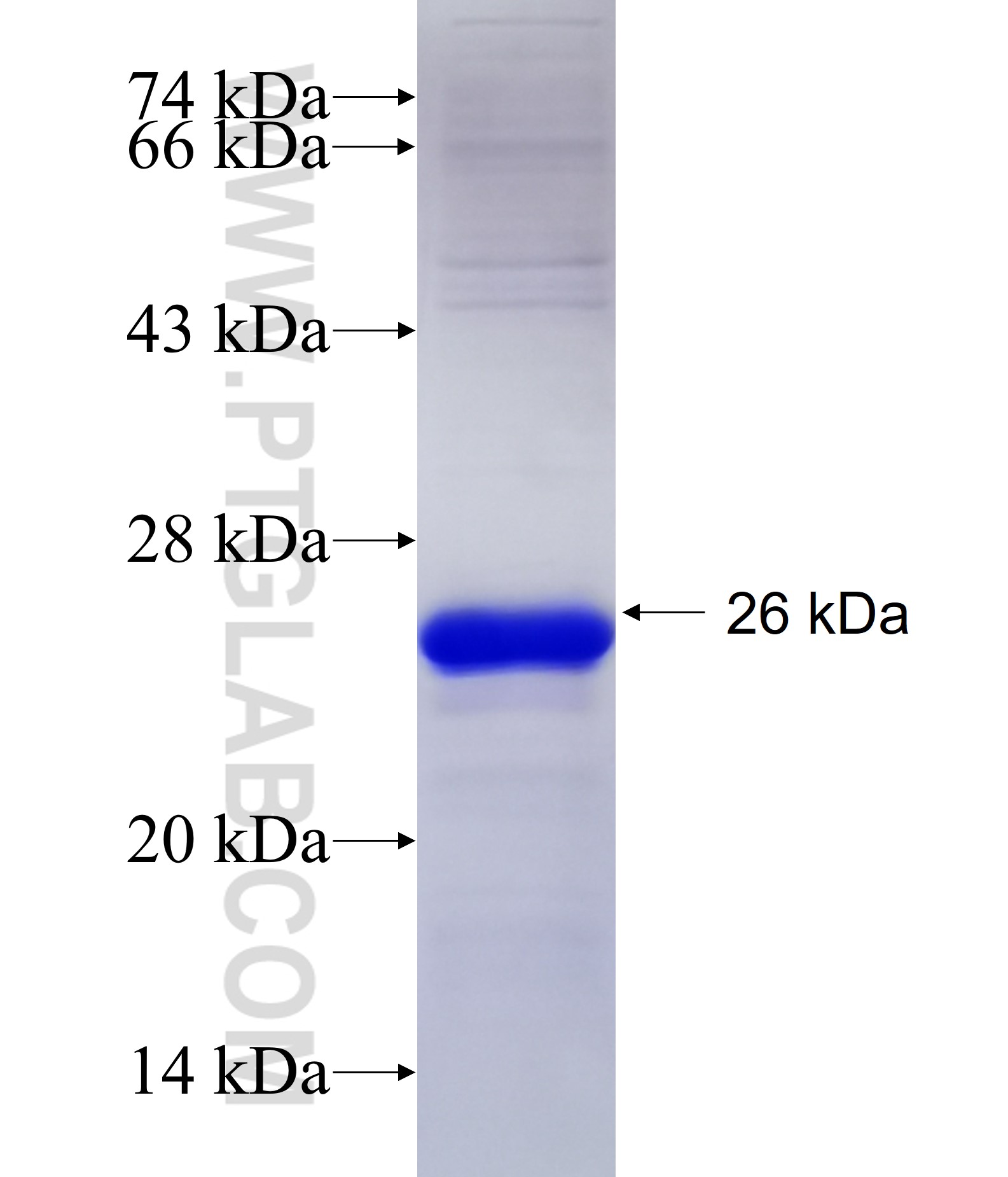 KLHL4 fusion protein Ag15948 SDS-PAGE KLHL4 fusion protein Ag15948 SDS-PAGE