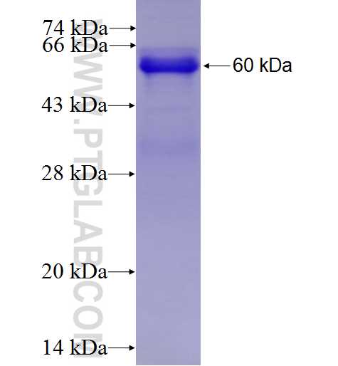 KLHL6 fusion protein Ag4441 SDS-PAGE KLHL6 fusion protein Ag4441 SDS-PAGE