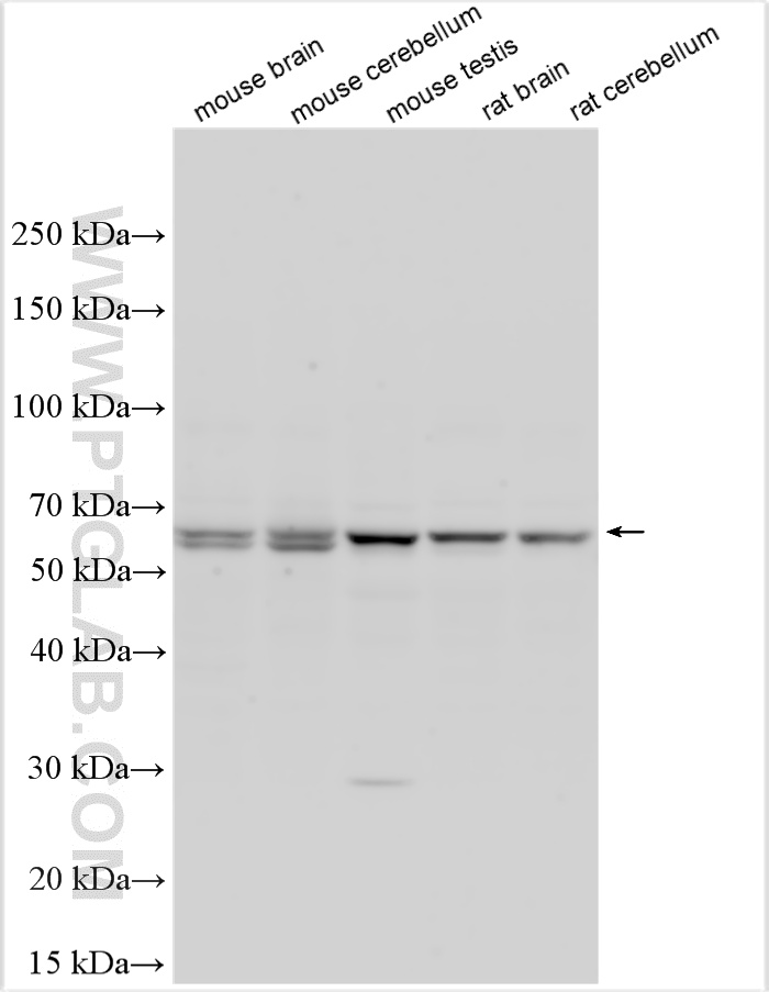 WB analysis using 32697-1-AP (same clone as 32697-1-PBS) WB analysis using 32697-1-AP (same clone as 32697-1-PBS)