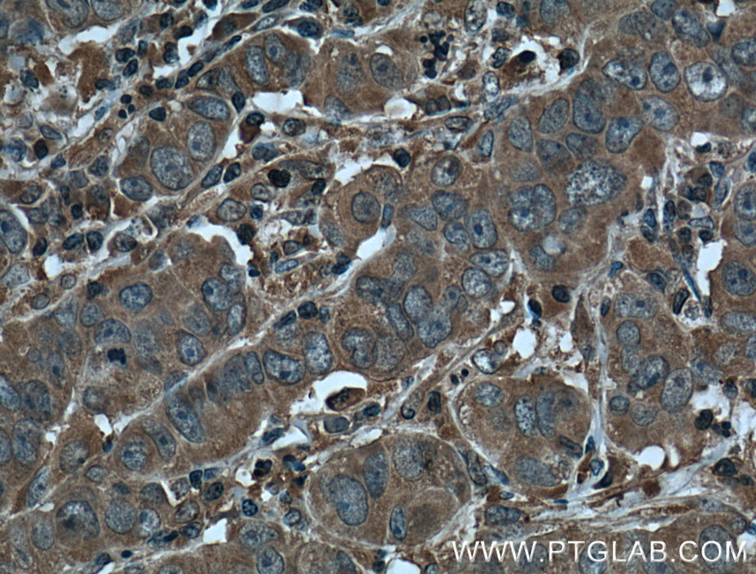 KLK3/PSA Monoclonal antibody