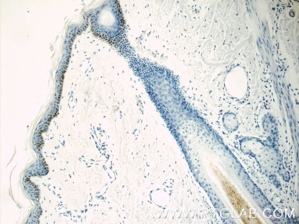 IHC staining of human skin using 10514-2-AP