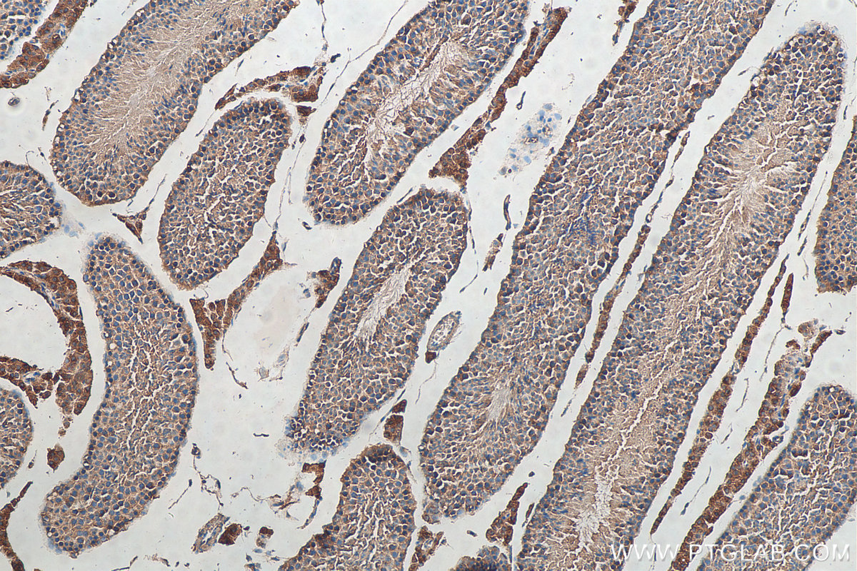 IHC staining of mouse testis using 10514-2-AP