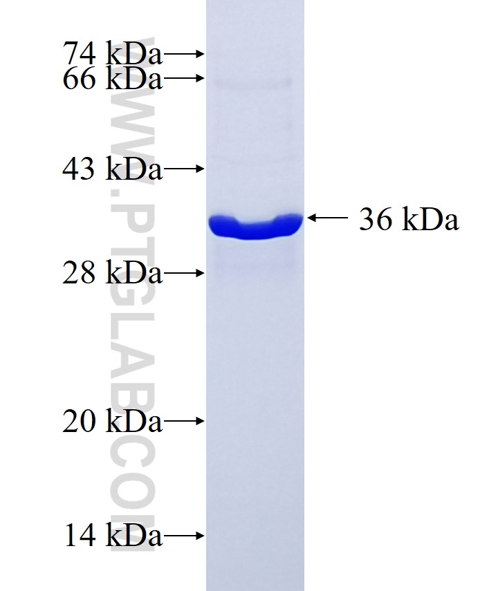 KLK6 fusion protein Ag25777 SDS-PAGE KLK6 fusion protein Ag25777 SDS-PAGE