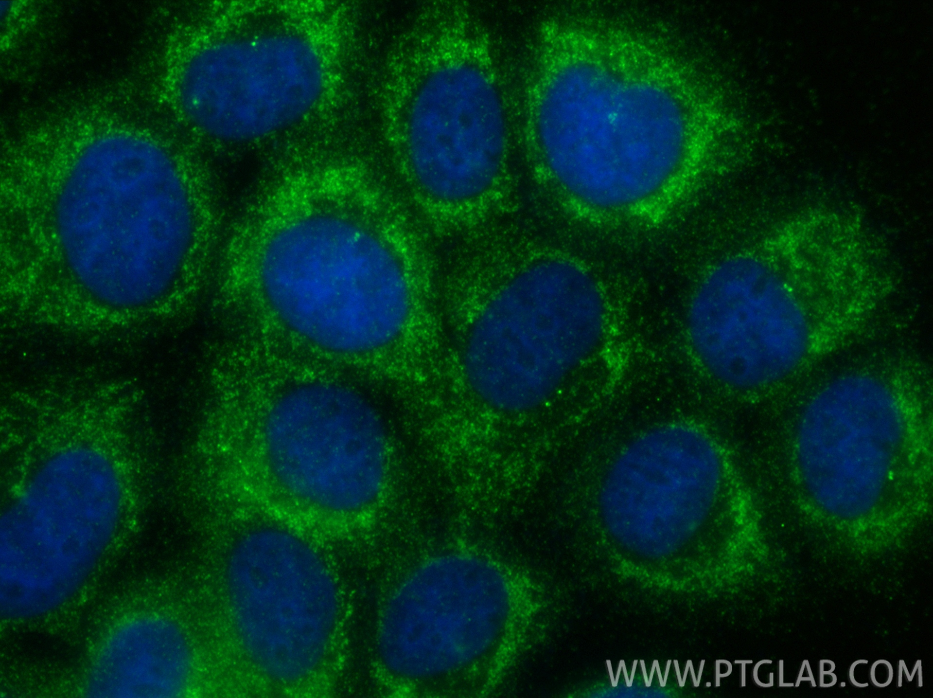 IF Staining of A431 using 23810-1-AP