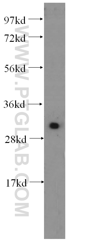 WB analysis of HeLa using 14232-1-AP