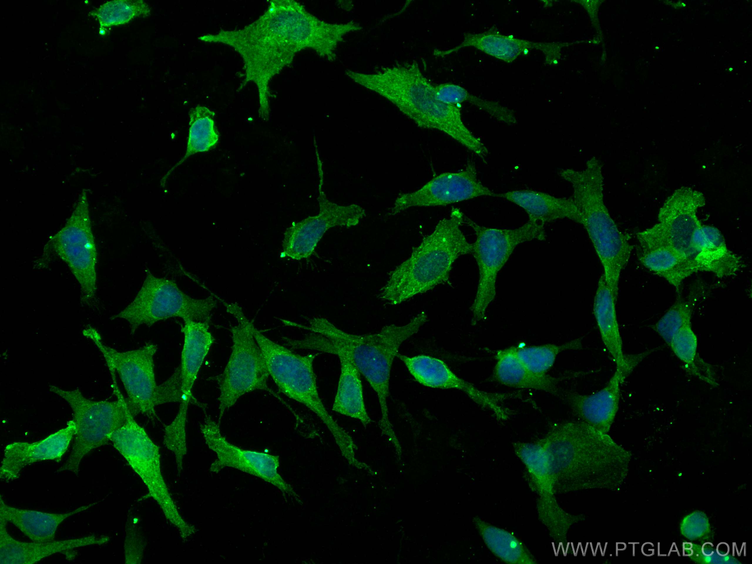 IF Staining of SH-SY5Y using 68247-1-Ig (same clone as 68247-1-PBS)
