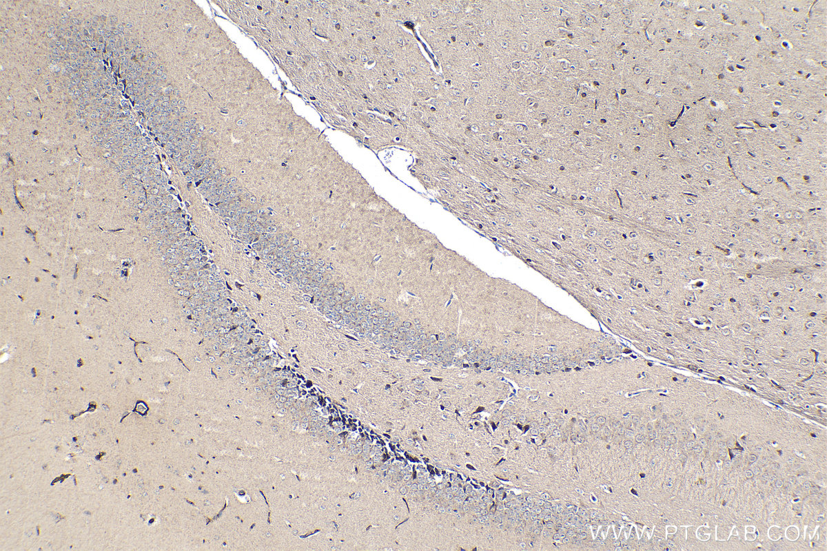 IHC staining of mouse brain using 68247-1-Ig (same clone as 68247-1-PBS)