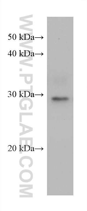 WB analysis of A431 using 68247-1-Ig