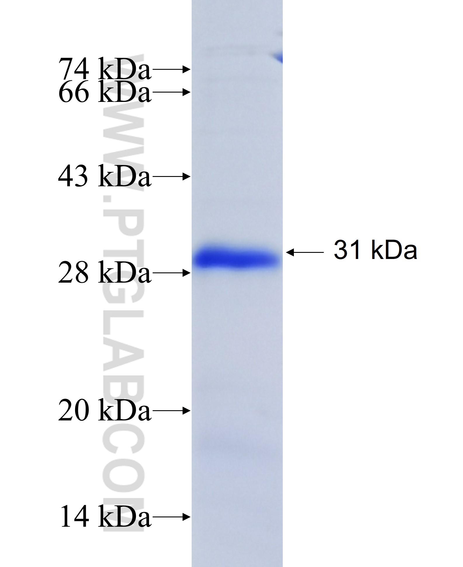 KLK8 fusion protein Ag41729 SDS-PAGE KLK8 fusion protein Ag41729 SDS-PAGE
