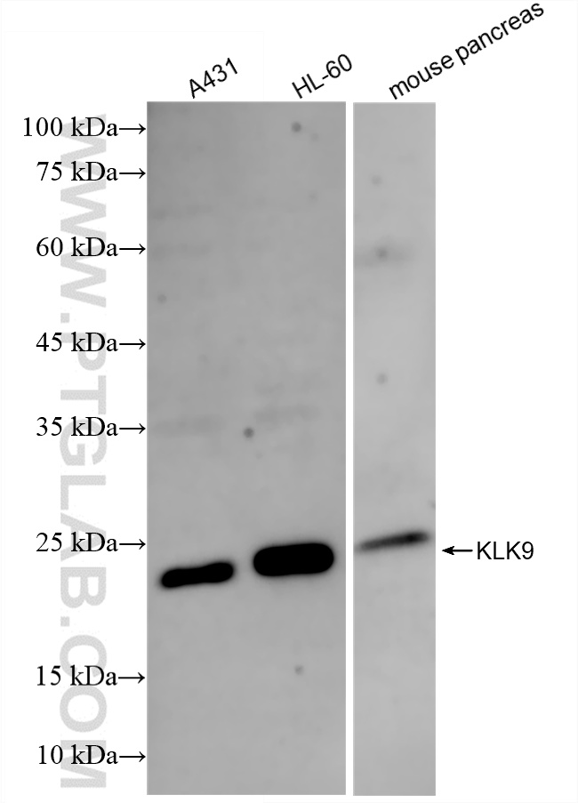 WB analysis using 86149-1-RR (same clone as 86149-1-PBS)