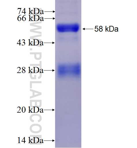 KLKB1 fusion protein Ag27491 SDS-PAGE