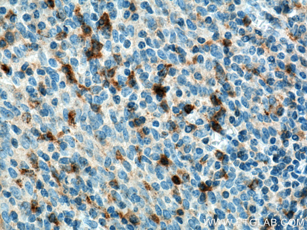 IHC staining of human tonsillitis using 67537-1-Ig