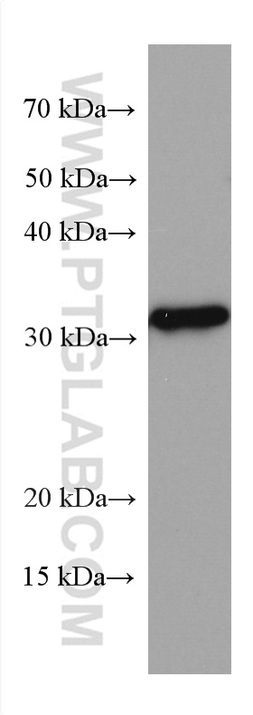 WB analysis of human spleen using 67537-1-Ig