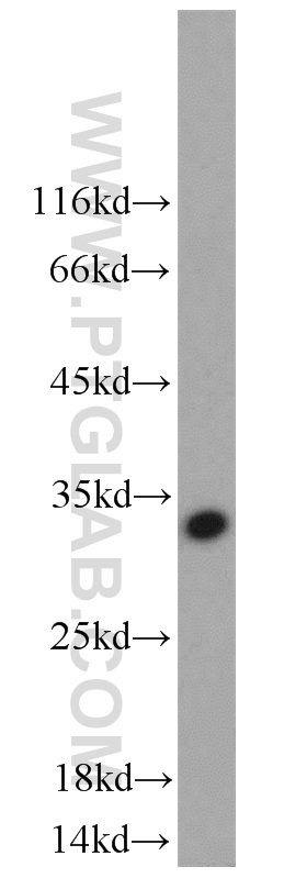 NKG2A Polyclonal antibody