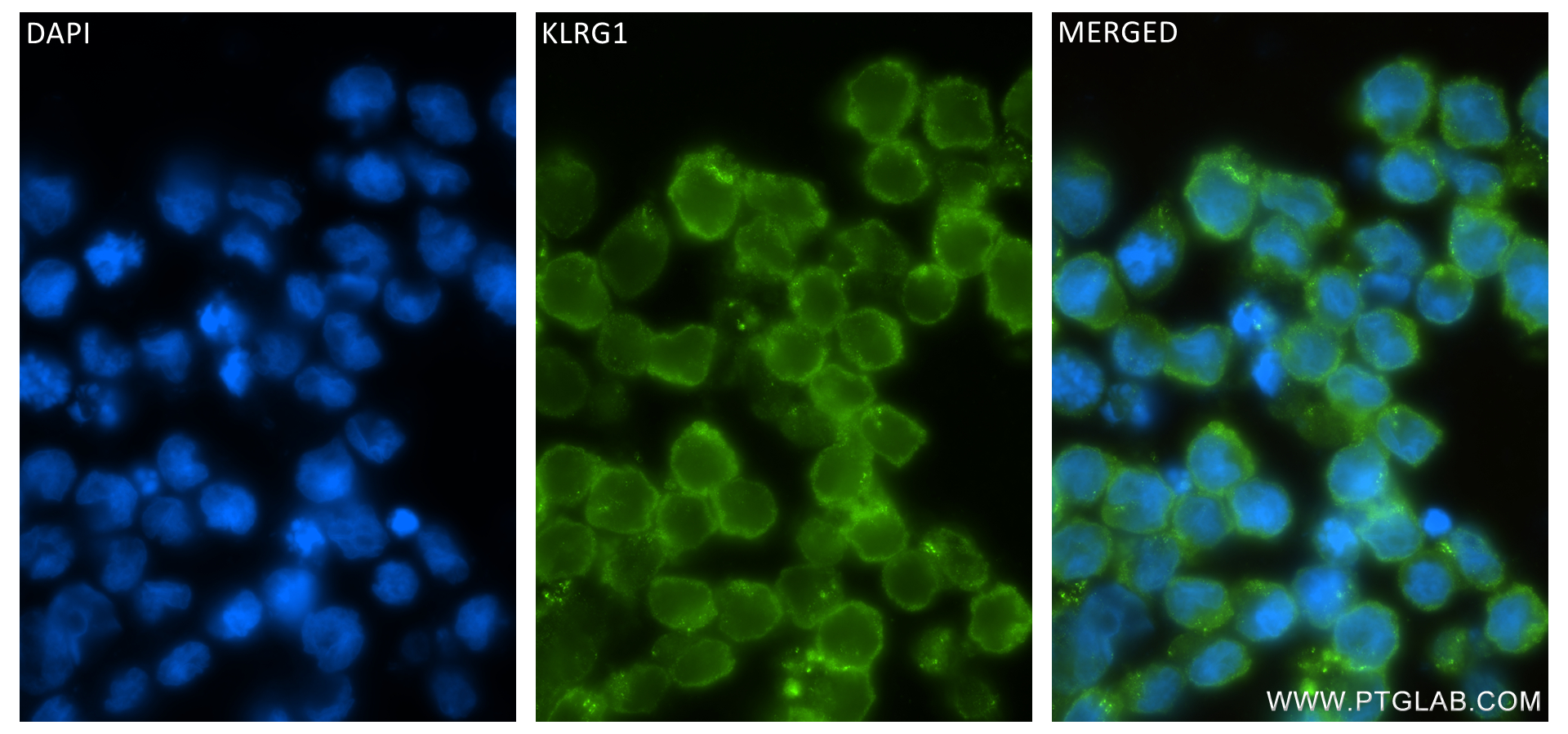 IF Staining of NK-92 using 84785-5-RR