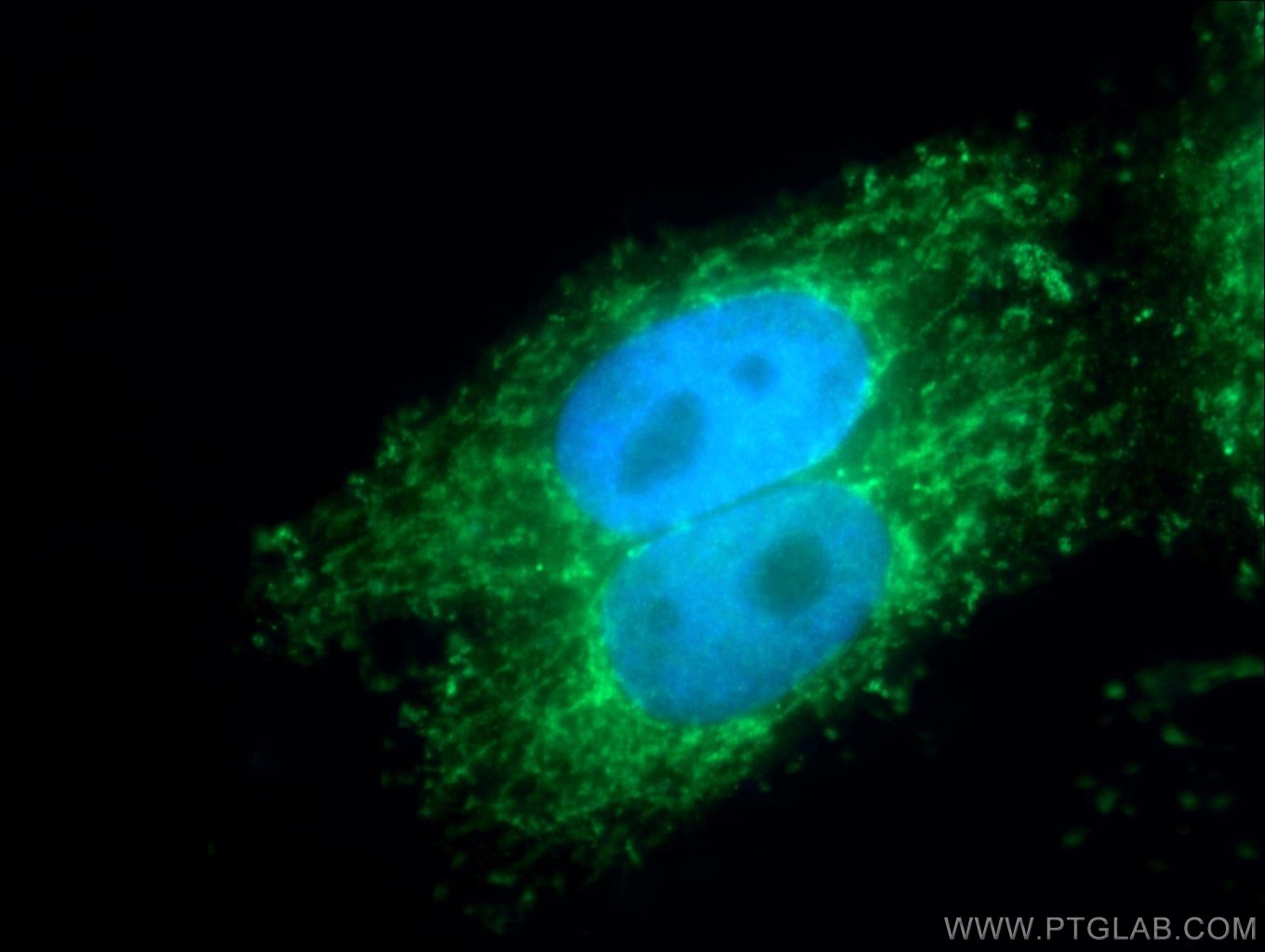 IF Staining of HepG2 using 10698-1-AP