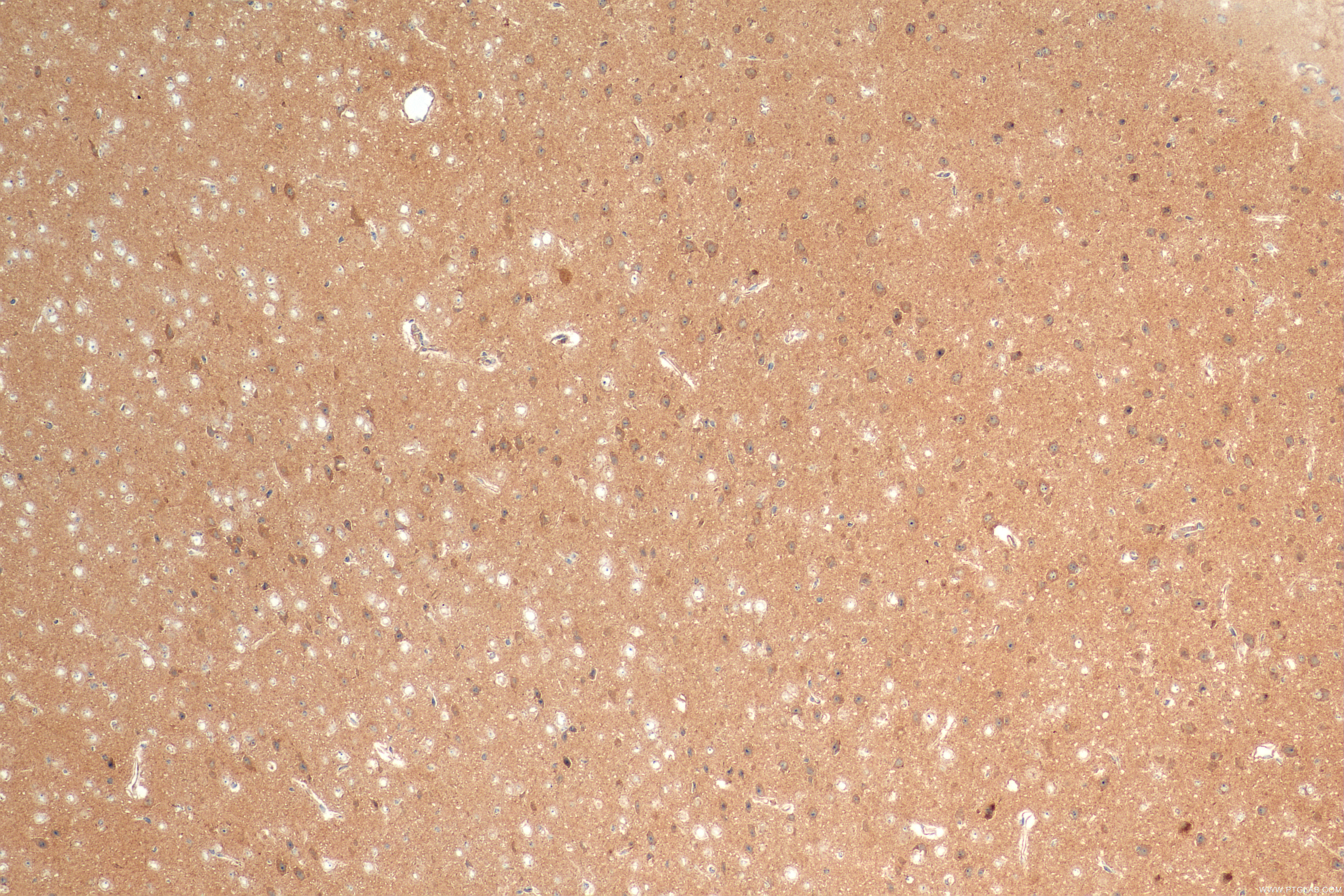 IHC staining of mouse brain using 83812-1-RR (same clone as 83812-1-PBS)