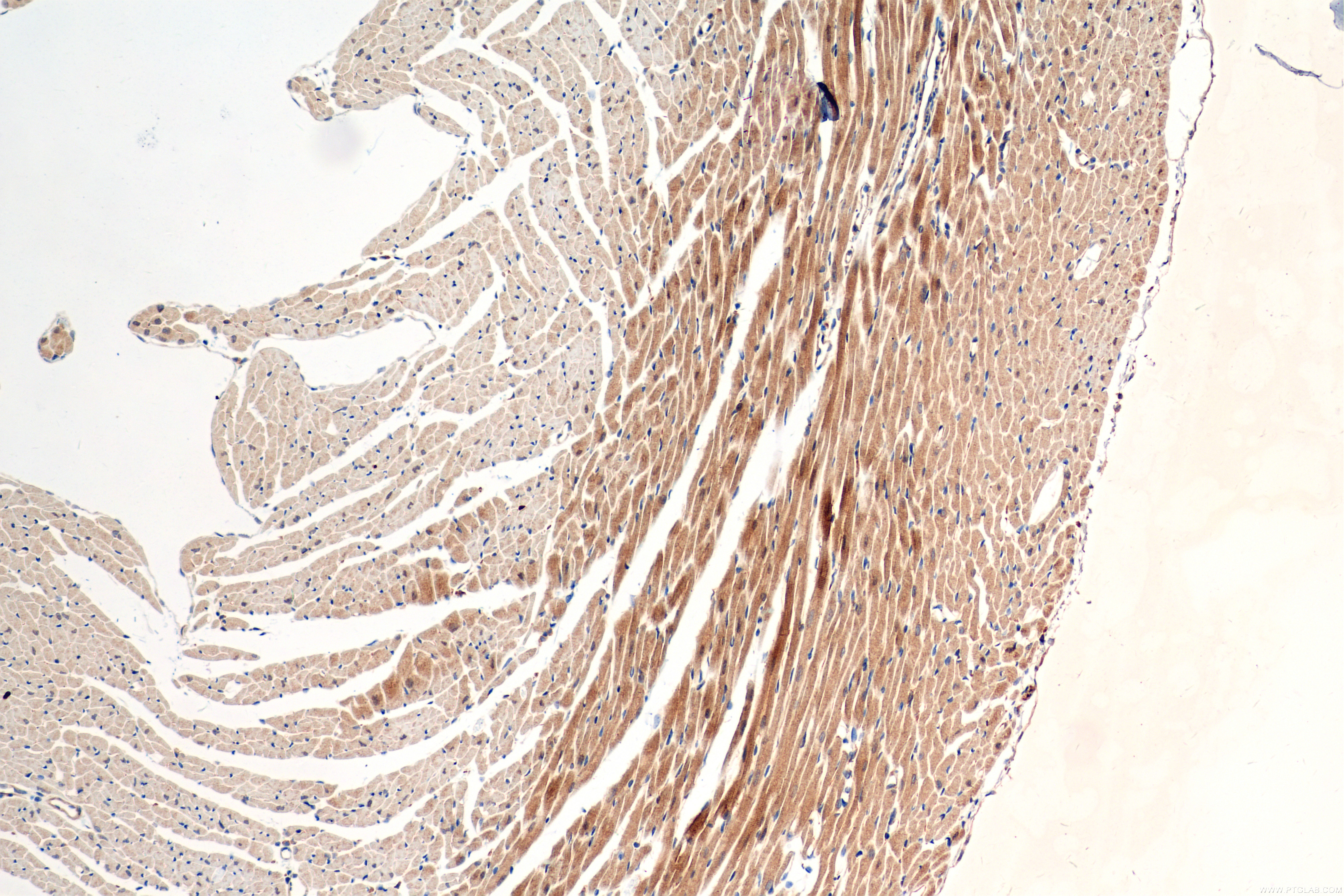 IHC staining of mouse heart using 83812-1-RR (same clone as 83812-1-PBS)