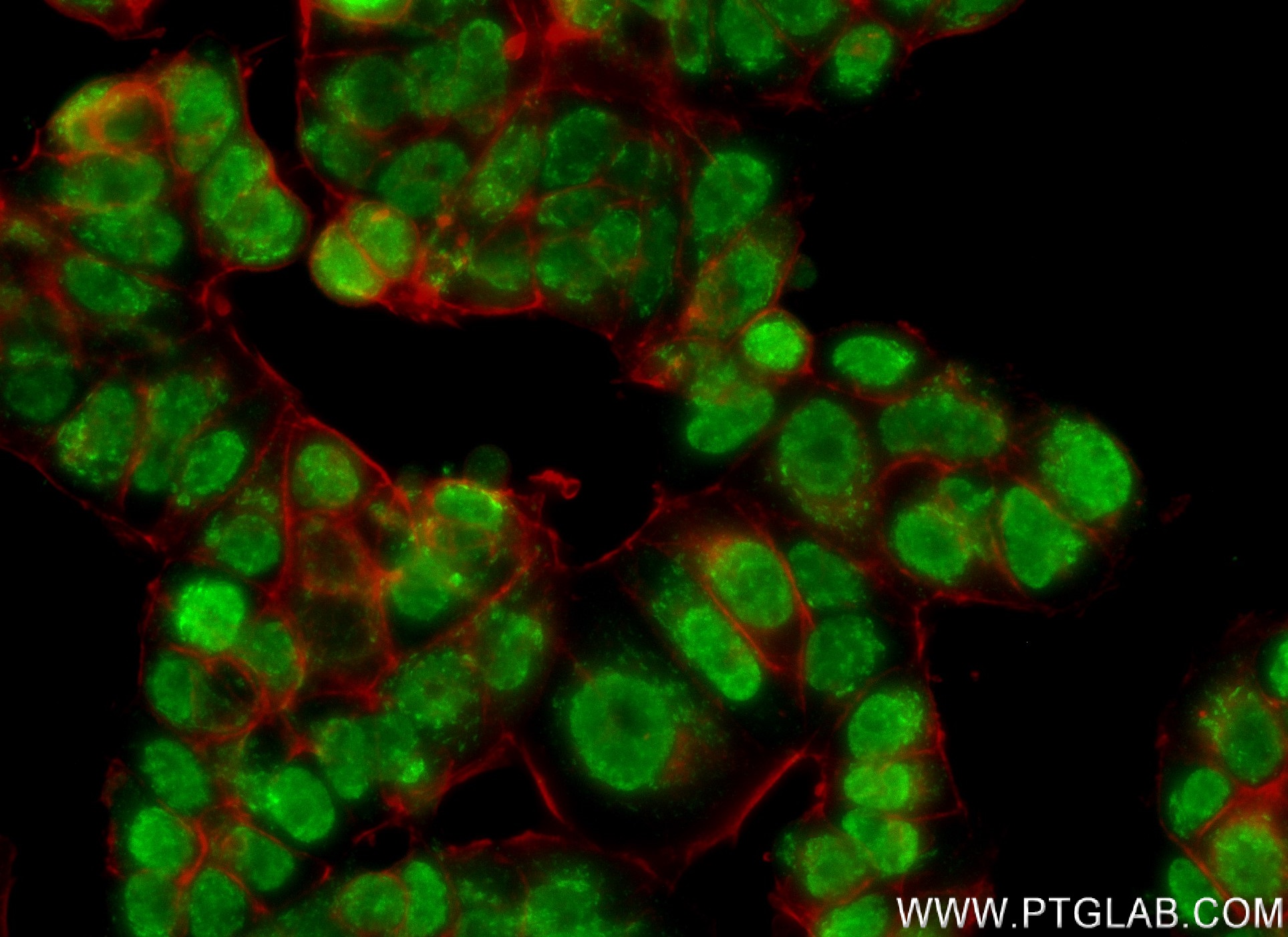 IF Staining of MCF-7 using 83595-4-RR (same clone as 83595-4-PBS)