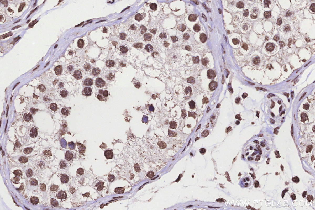 IHC staining of human testis using 83595-4-RR