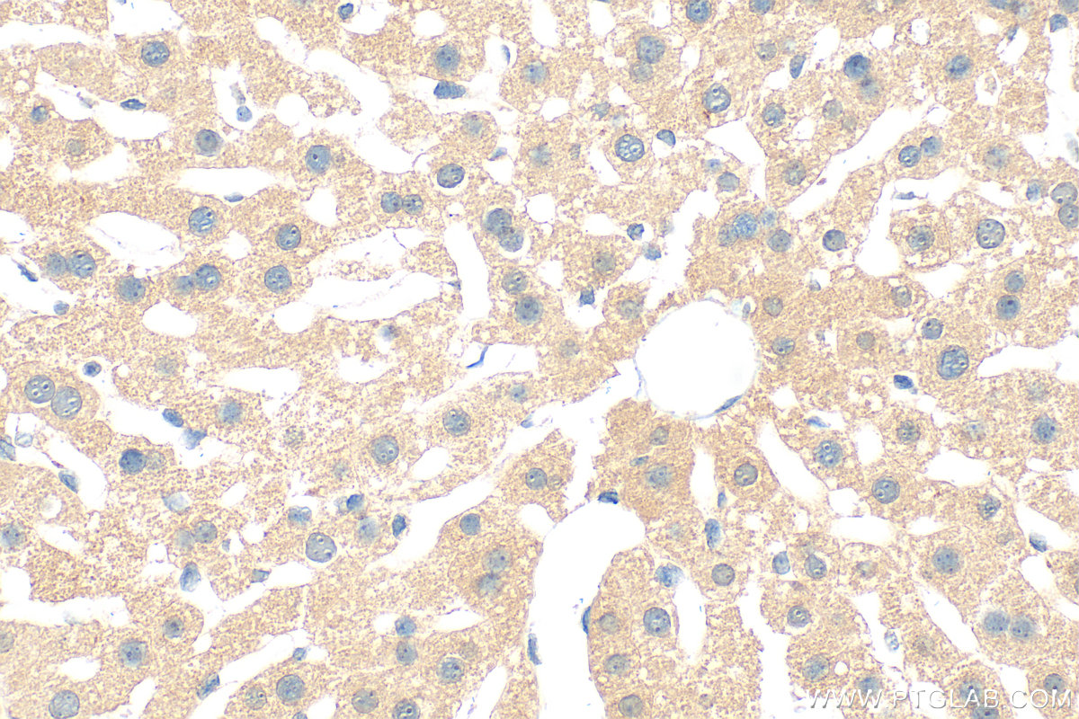 IHC staining of mouse liver using 21532-1-AP (same clone as 21532-1-PBS) IHC staining of mouse liver using 21532-1-AP (same clone as 21532-1-PBS)