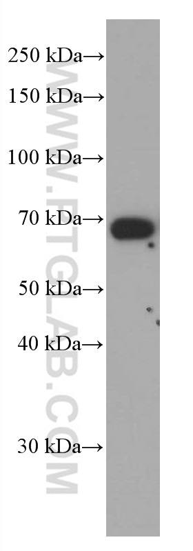 WB analysis of human heart using 66123-1-Ig (same clone as 66123-1-PBS)