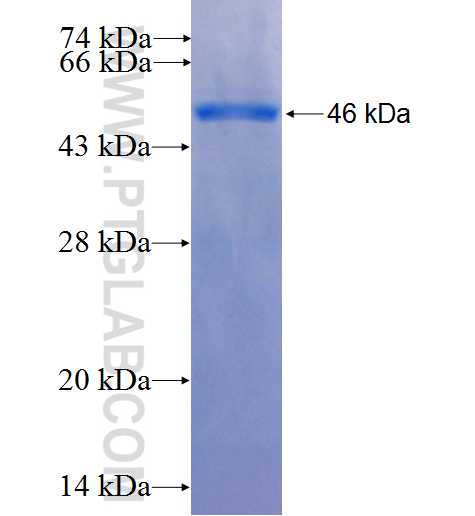 KNG1 fusion protein Ag26467 SDS-PAGE