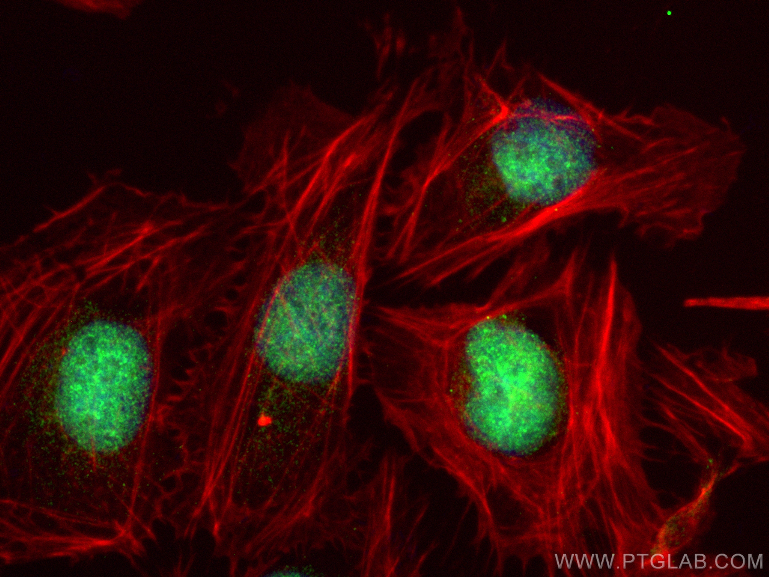 IF Staining of U2OS using 28695-1-AP