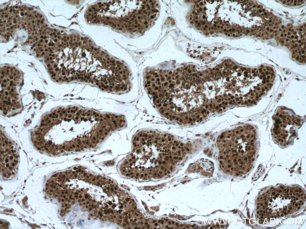 IHC staining of human testis using 18137-1-AP