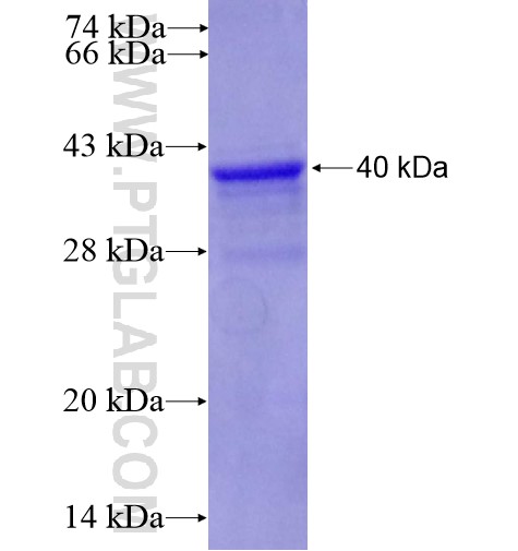 KPNA1 fusion protein Ag12751 SDS-PAGE